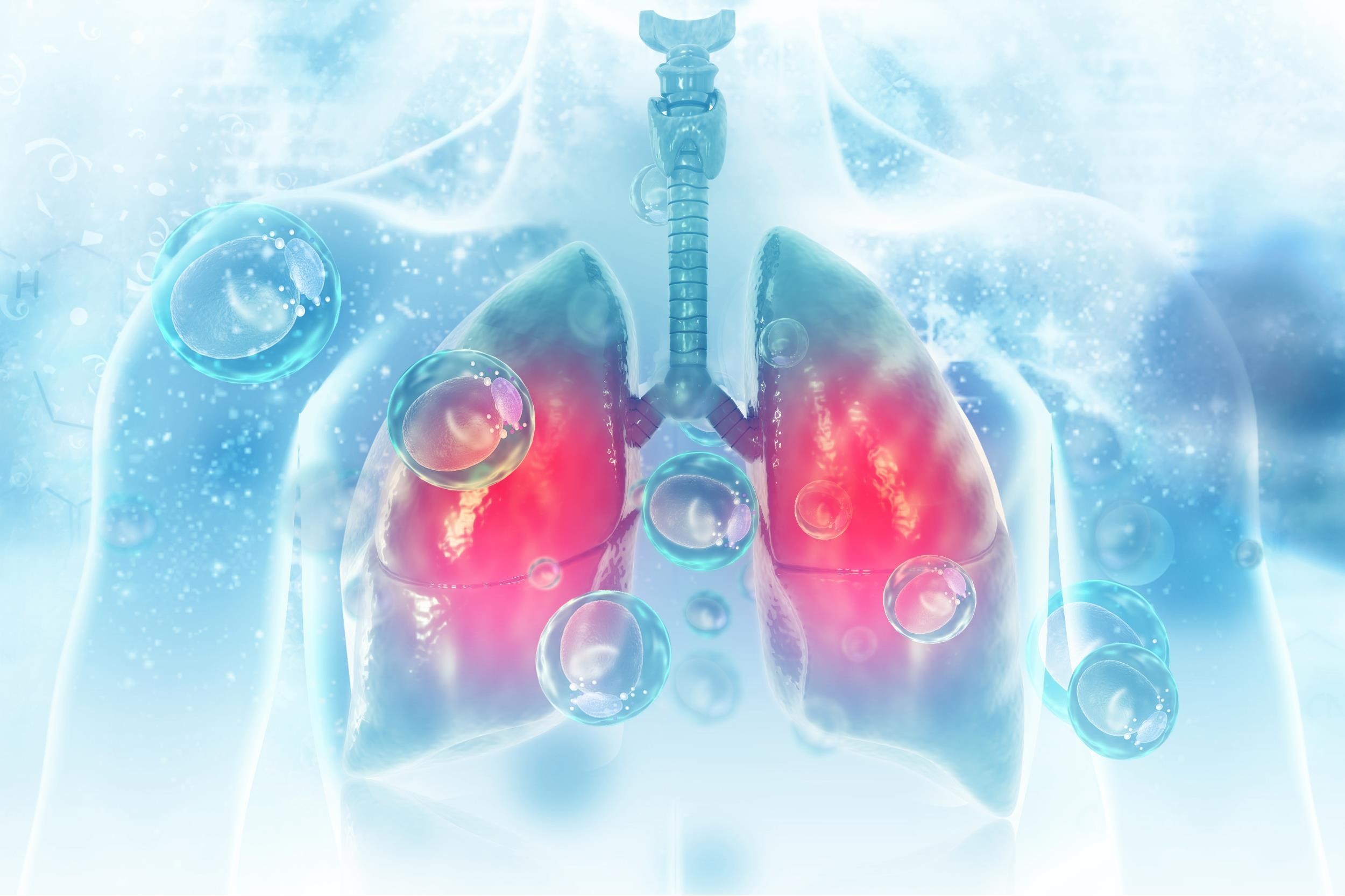 Làm thế nào để phát hiện lao phổi?
