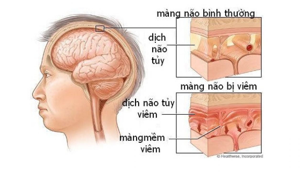 Vi&ecirc;m m&agrave;ng n&atilde;o