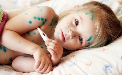 Bệnh thủy đậu